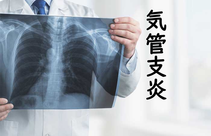  ¿クアレスの息子は、環境に影響を与えていますか?